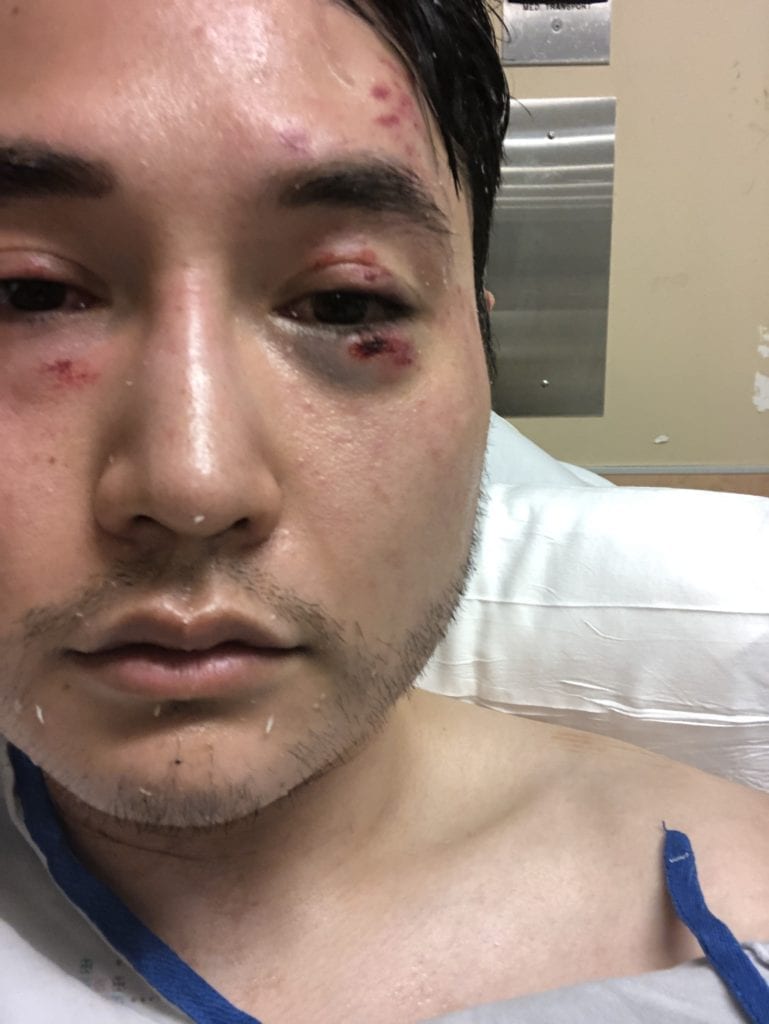 Justice for Andy Ngo