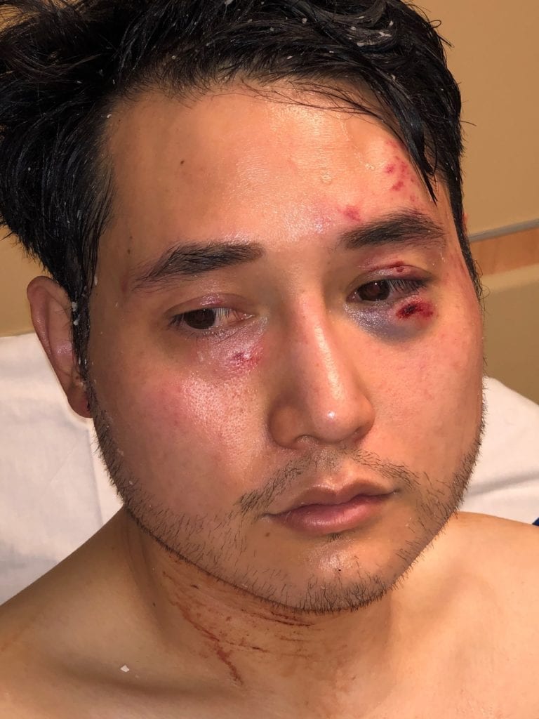 Justice for Andy Ngo